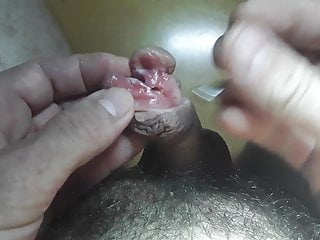 Cutting e subincision