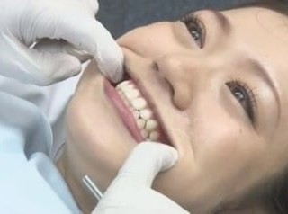 Tinh dịch Nuốt chút tại Văn phòng Dentist